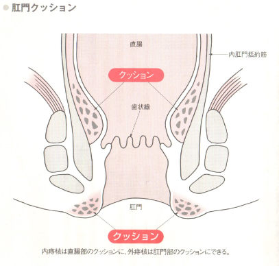 肛門クッション