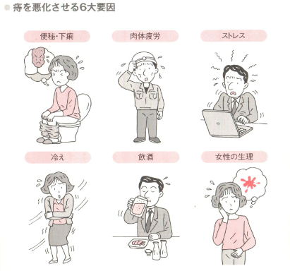 痔を悪化させる6大要因