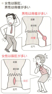 女性と男性の症状比較