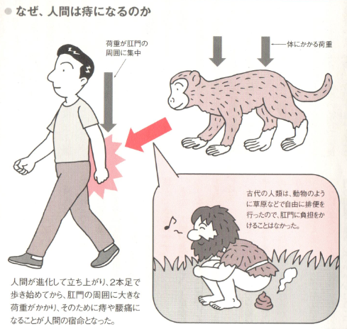 人間が痔になる理由 痔の治療なら 東京青山 平田肛門科医院 人間が痔になる理由 痔の治療なら 東京青山 平田肛門科医院