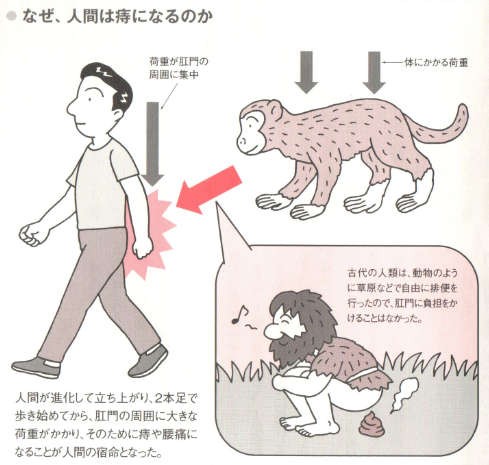 人間が痔になる理由 痔の治療なら 東京青山 平田肛門科医院