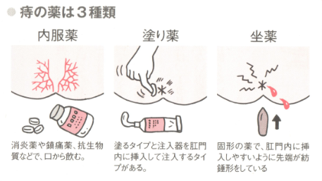 薬 切れ 痔 市販