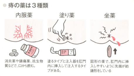 痔の薬の種類 痔の治療なら 東京青山 平田肛門科医院 痔の薬の種類 痔の治療なら 東京青山 平田肛門科医院