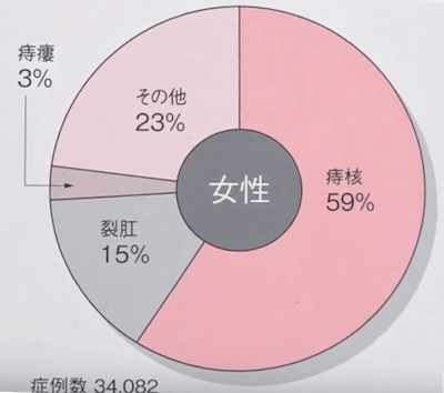 おしりの医学 011 なぜ女性は痔になりやすいのか 痔の治療なら 東京青山 平田肛門科医院 おしりの医学 011 なぜ女性は痔になりやすいのか 痔の治療なら 東京青山 平田肛門科医院